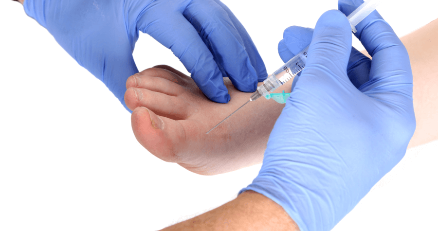 Foot joint and soft tissue injections in Suffolk